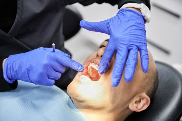 Best Emergency Dentist for Lost Fillings or Crowns in King Cove, AK